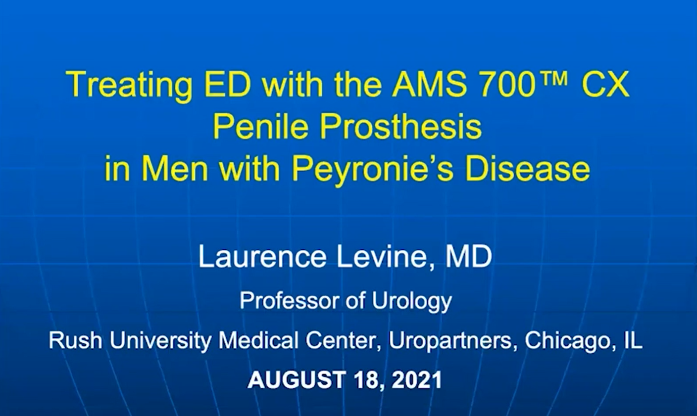 Treating ED with the AMS 700 CX Penile Prosthesis in Men with Peyronie's Disease