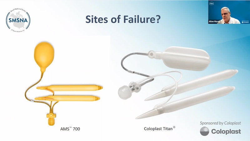 Mechanical Indications for Inflatable Penile Prosthesis Revision